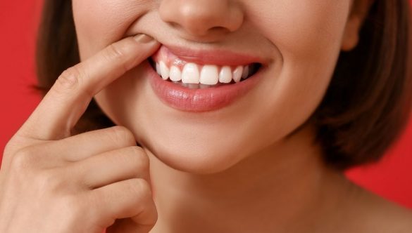 ¿Es realmente necesario un levantamiento de encías para su salud bucal?