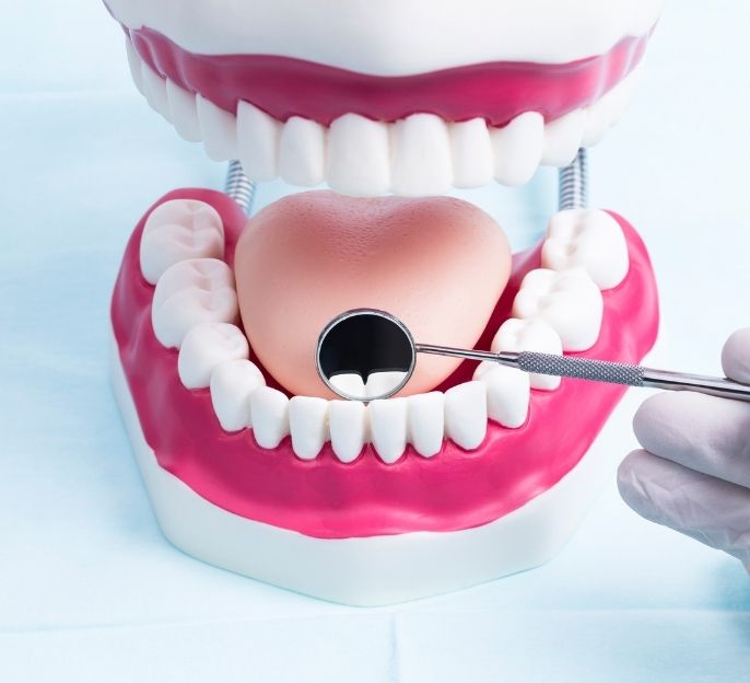 imagen de Odontologia Conservadora en Amorebieta tratamientos clinica dental